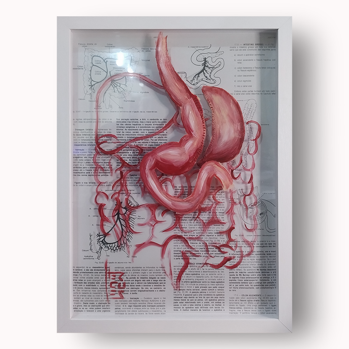 Anatomía del marco decorativo – Manga gástrica bariátrica-estómago™ | Pintura original