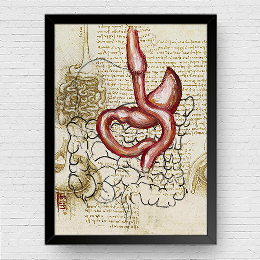 Marco de póster de anatomía: boceto de bypass gástrico del estómago Da vinci 