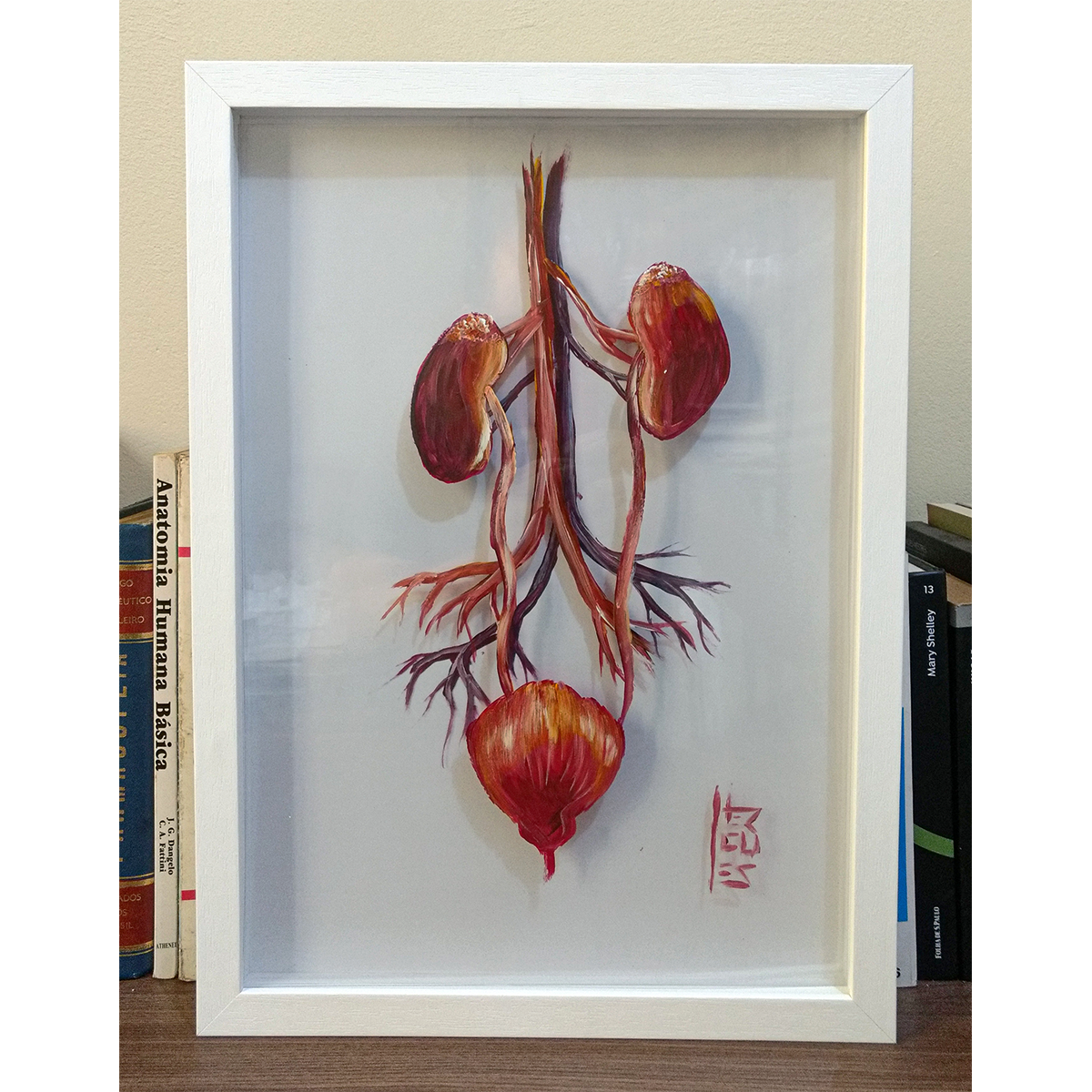 Cuadro Anatomía: Pintura original Vías urinarias fondo blanco 